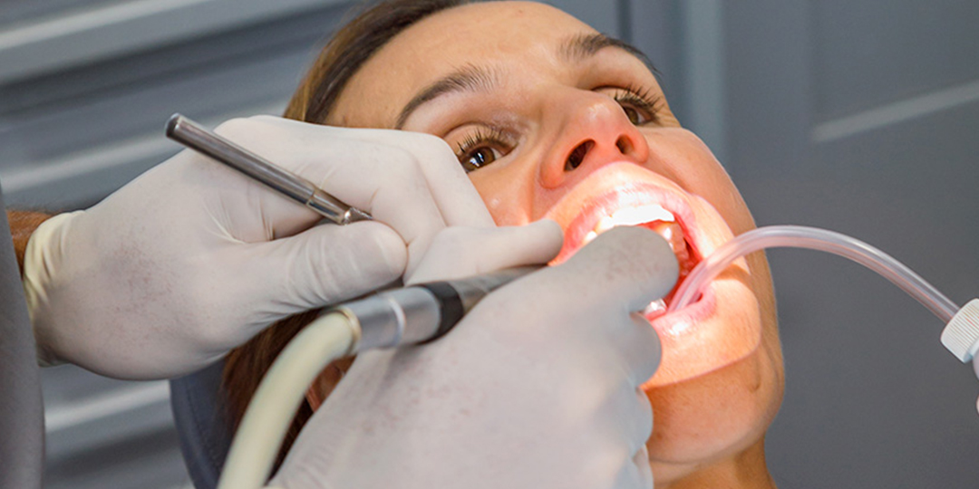 estetica dental, tratamientos del Dr Justo M Balaguer